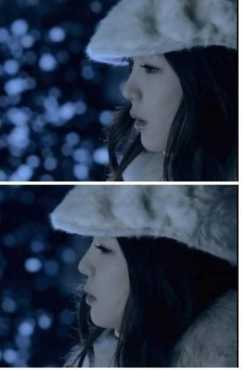 park-bom-cua-2ne1-tung-phau-thuat-tham-my-2