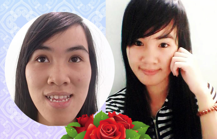 “Phép màu kì diệu” biến đổi cuộc sống cô gái bị móm nặng