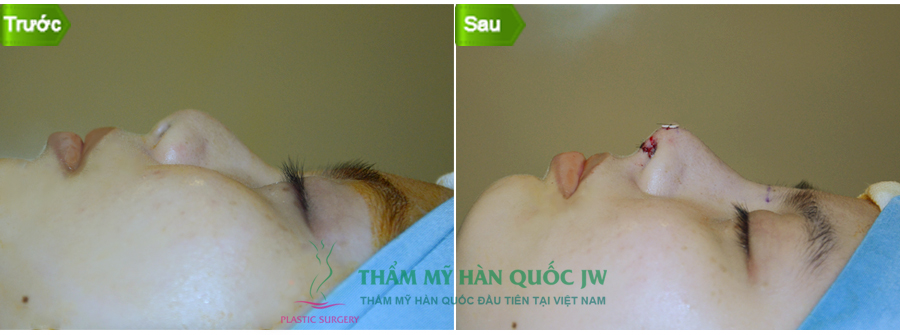 chuyen-tham-va-lam-viec-cua-ts-bs-man-koon-suh-tai-viet-nam-5