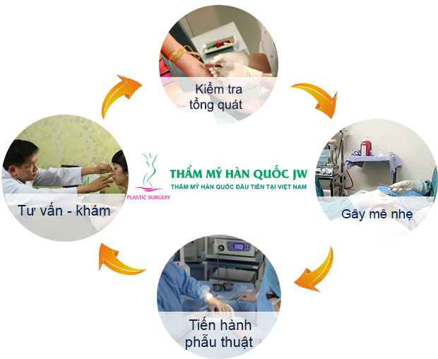 Nâng mũi S Line Nâng mũi S Line