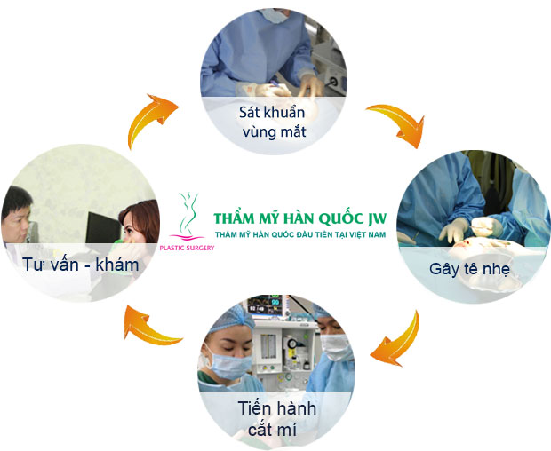 Cắt mí mắt thành 2 mí
