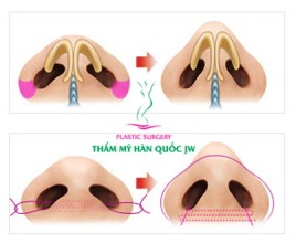 Massage thu gọn cánh mũi