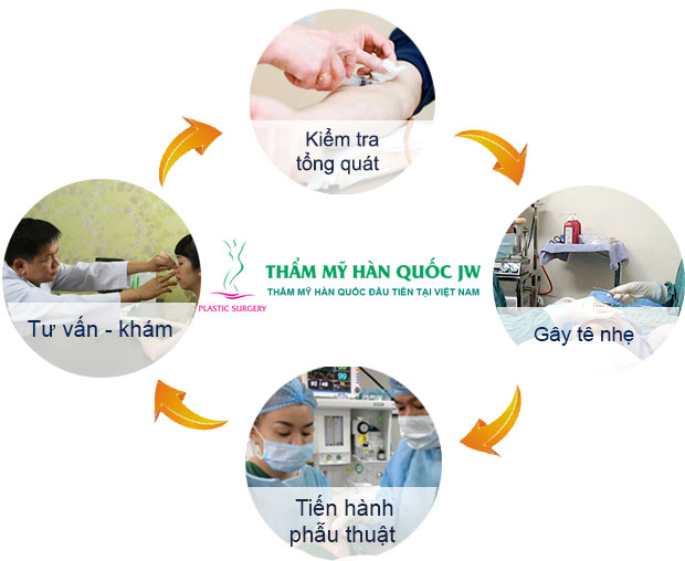 Nâng mũi bọc sụn tự thân giá bao nhiêu Nâng mũi bọc sụn tự thân giá bao nhiêu