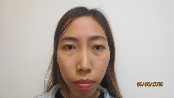 hồng anh 1