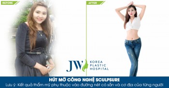 hut-mo-bang-cong-nghe-laser-sculpsure-o-dau-chat-luong