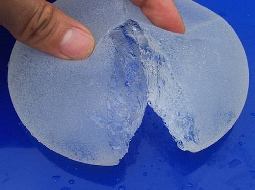 Hiện nay, túi nước biển không được sử dụng trên thị trường nữa thay vào đó là nâng ngực túi gel.