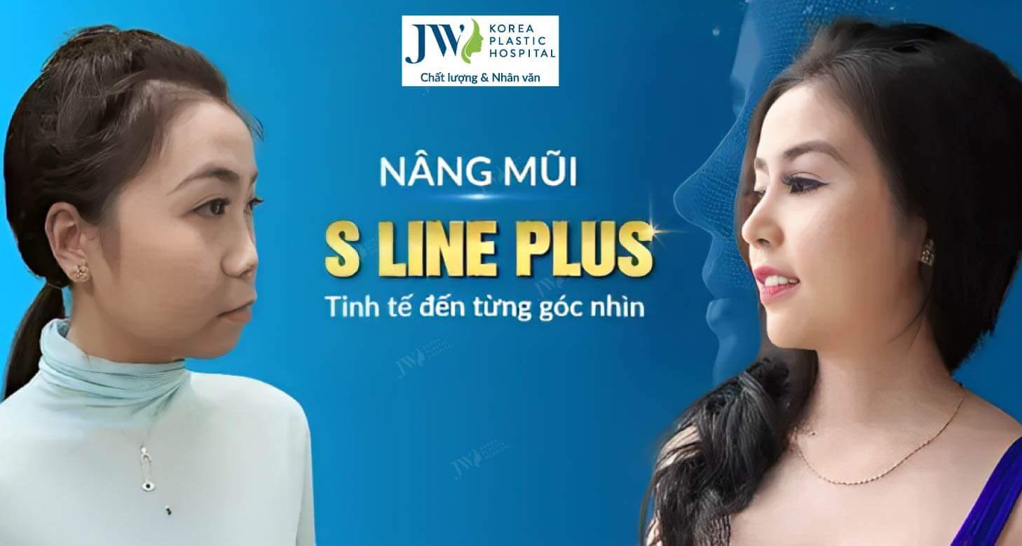 nang mui s line plus dep moi goc nhin