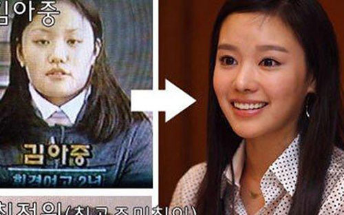 kim-ah-joong-bi-nghi-ngo-dao-keo-3