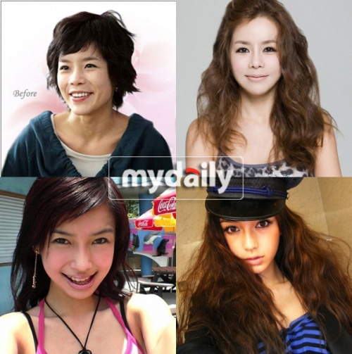 shin-ee-lot-xac-nho-phau-thuat-tham-my-2