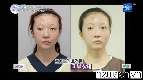 Cô gái trẻ được cứu giúp nhờ phẫu thuật thẩm mỹ