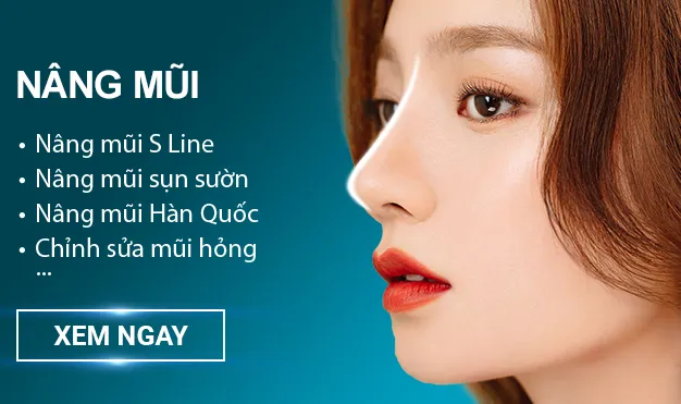 Nâng mũi