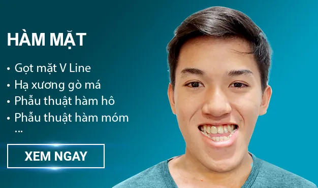 Nâng ngực đẹp
