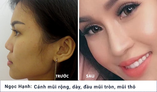 hình ảnh khách hàng