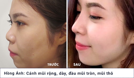 hình ảnh khách hàng