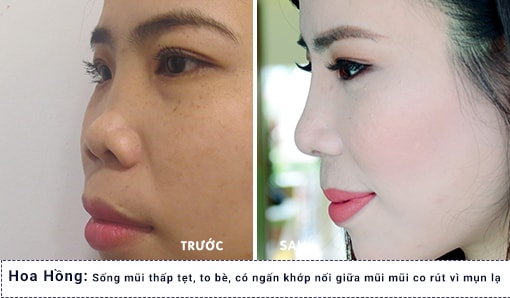 hình ảnh khách hàng