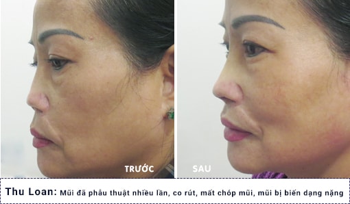 hình ảnh khách hàng