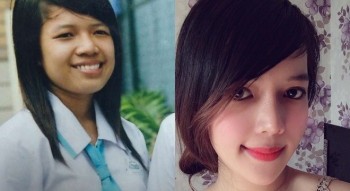 Câu chuyện đằng sau đôi mắt đẹp của nàng hotgirl