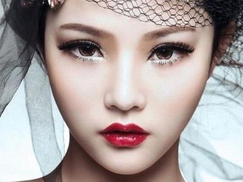 Nâng mũi bọc sụn Alloderm