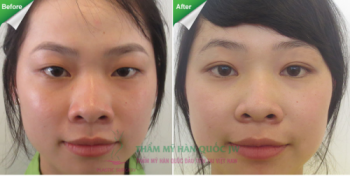 Xin việc dễ dàng hơn nhờ đôi mắt hút hồn