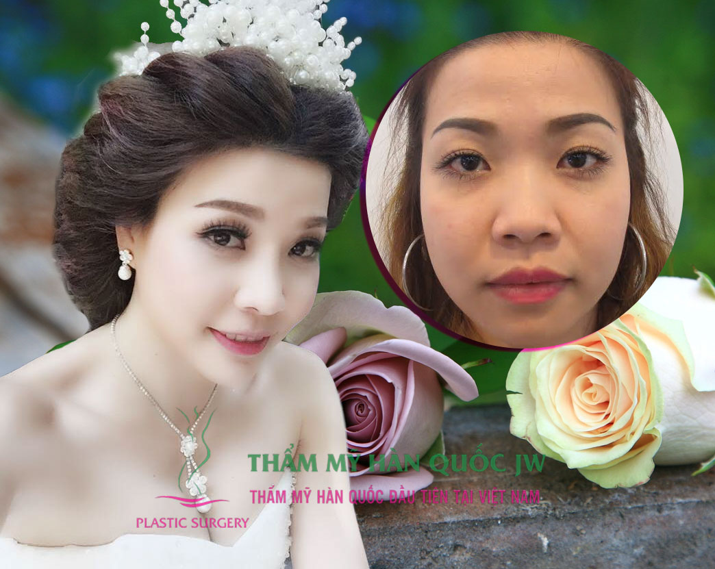 Nữ huấn luận viên thể dục thẩm mỹ: Phẫu thuật thẩm mỹ hay trang điểm thì cũng chỉ là “vẻ đẹp nhân tạo” mà thôi.