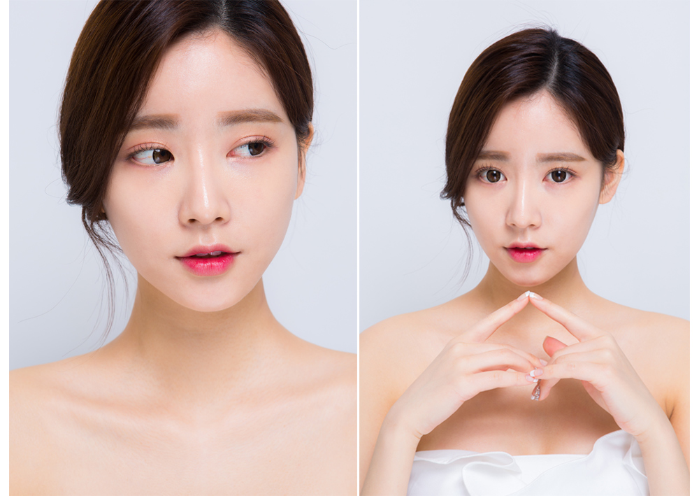 nâng mũi s line megaderm