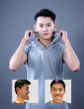 Những Người Phẫu Thuật Thẩm Mỹ Thay Đổi Hoàn Toàn Gương Mặt