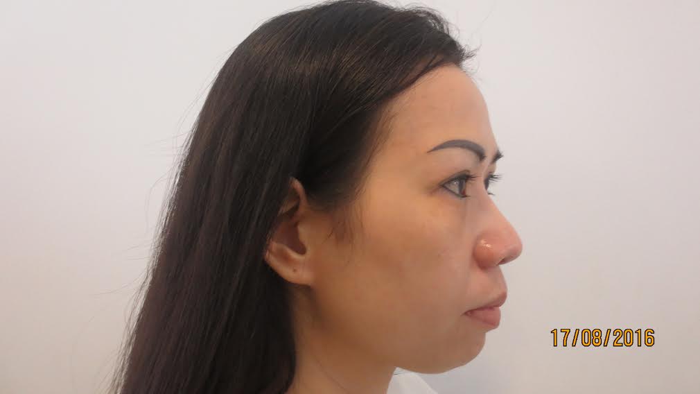 kim phượng 3