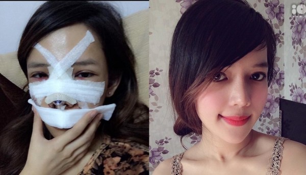 minh yến