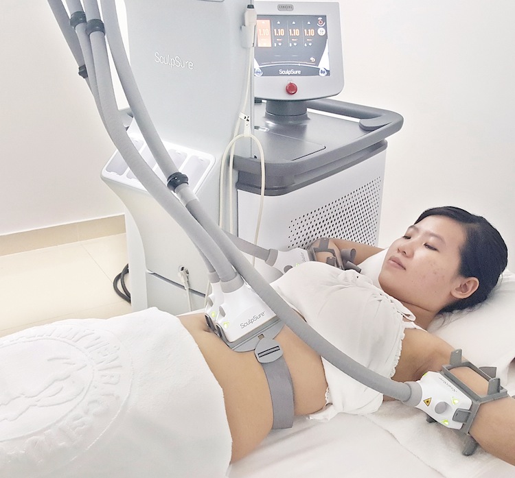 thon-gon-co-the-voi-phuong-phap-laser-sculpsure-hinh-anh-2.jpg