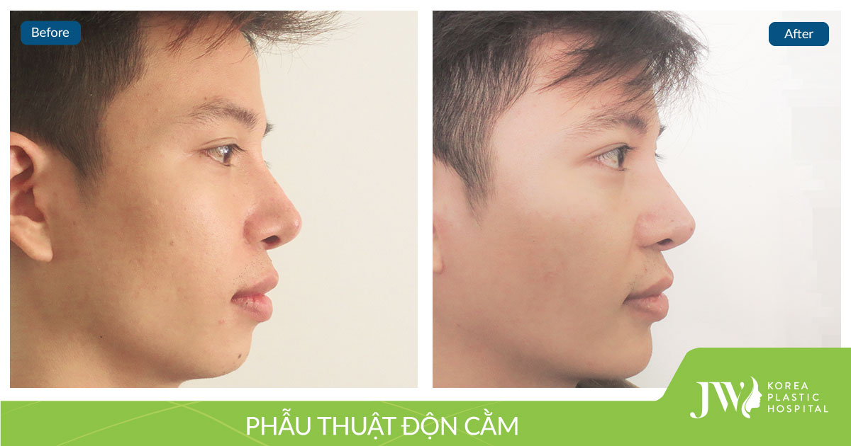 Nguyễn-Ngọc-Anh---13.6 (1)