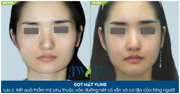 Hình ảnh gọt mặt