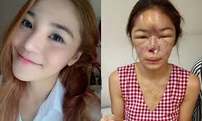 phau-thuat-tham-my-con-dao-2-luoi-ban-can-luu-y