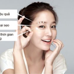 Thẩm mỹ mắt Circle eye – bước đột phá mới trong ngành làm đẹp