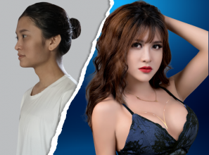 Bảng giá thẩm mỹ ngực, mông