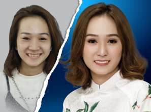 Bảng giá phẫu thuật mắt