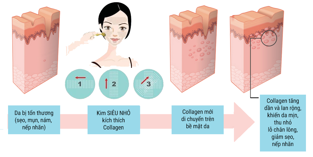 cơ chế hoạt động