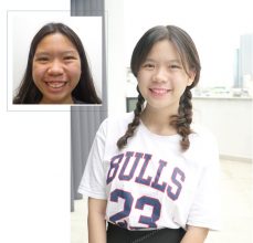 Phẫu thuật hàm hô và tính nhân văn trong ngành thẩm mỹ