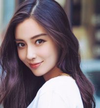Chi phí phẫu thuật hàm hô – Chất lượng luôn đi đôi với giá cả