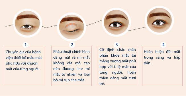 Thẩm mỹ mắt