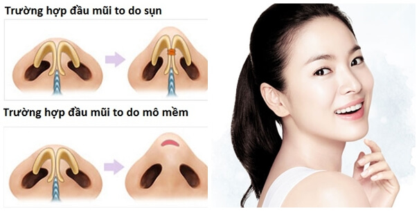 thu-gon-dau-mui-2