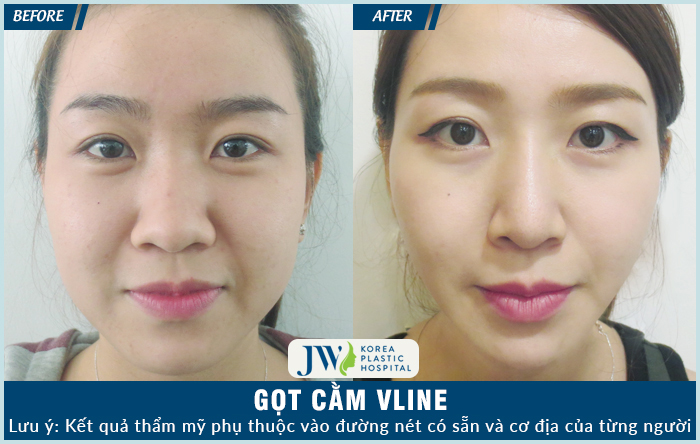 cam-v-line-5
