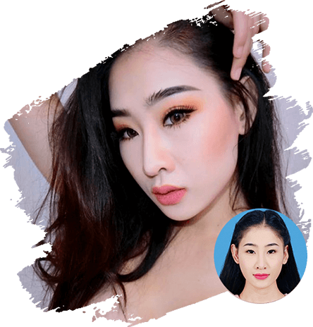 Nữ DJ Oxy và câu chuyện về chiếc mũi gãy