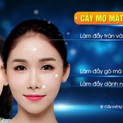 Cấy mỡ mặt Baby Face – Trẻ hóa toàn diện, bền vững 10 năm