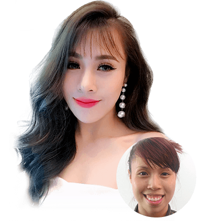 Biên Đạo múa Lan Nhi đẹp “vạn người mê” sau phẫu thuật hàm hô