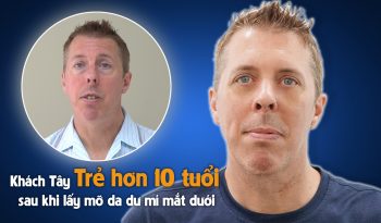 Trẻ hơn 10 tuổi “Ông Tây” điển trai kể về thẩm mỹ lấy mỡ bọng mắt