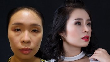 Diễn viên  hài Việt Trang lần đầu công khai mục đích thẩm mỹ mũi