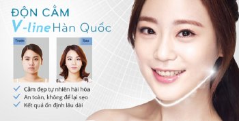 Giá độn cằm V Line – Công nghệ độc quyền Hàn Quốc