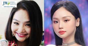 Thực hư chuyện ca sĩ Miu Lê sửa mũi?