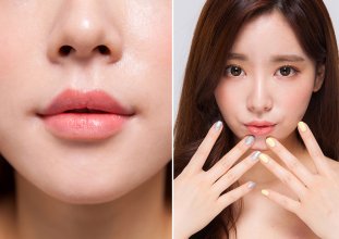 Thẩm mỹ môi trái tim cho nàng đẹp quyến rũ