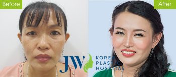 Cách xử lý khôn khéo của nữ doanh nhân khi bị chê ngoại hình